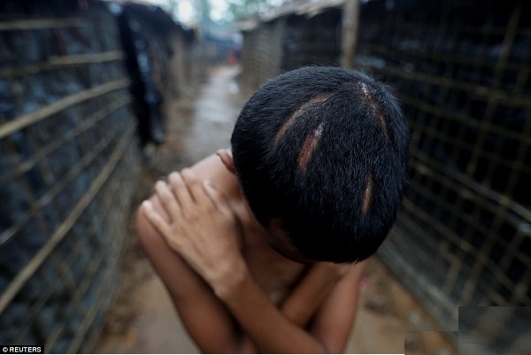 تازهترین تصاویر از وضعیت دردناک مسلمانان روهینگیا تازهترین تصاویر از وضعیت دردناک مسلمانان روهینگیا
