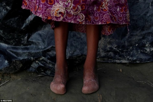 تازهترین تصاویر از وضعیت دردناک مسلمانان روهینگیا تازهترین تصاویر از وضعیت دردناک مسلمانان روهینگیا