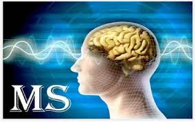 افزایش تعداد مبتلایان به ام. اس در کشور