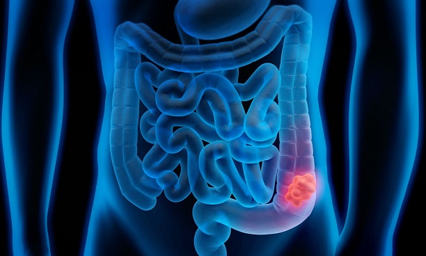 حال خوشِ مرغی که از قفس پرید( لطفا منتشر نشود) حال خوشِ مرغی که از قفس پرید( لطفا منتشر نشود)