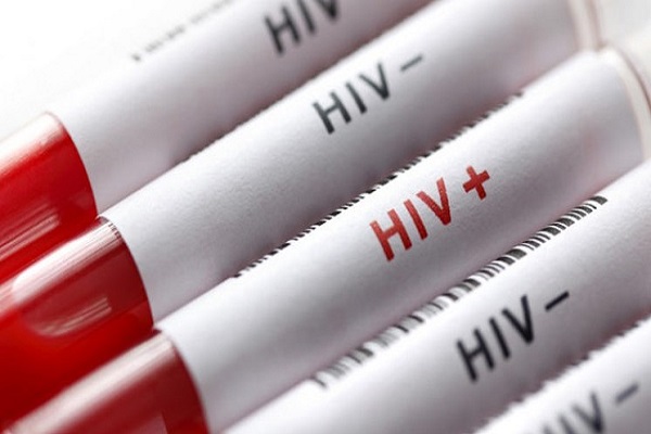 تولد 4 نوزاد سالم از مادران مبتلابه HIV ایدز در حوزه دانشگاه علوم پزشکی زاهدان