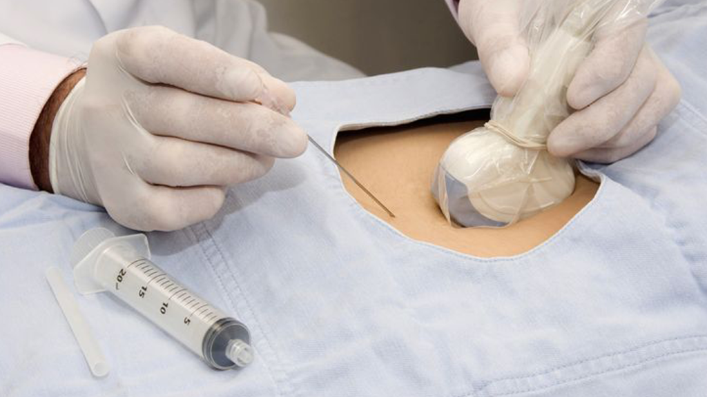 **غربالگری پیش از تولد حذف نشده است///عکس سایز نیست /// عکس با کیفیت لطفا